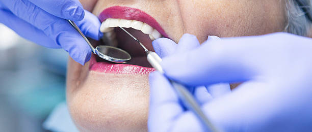 Tooth Infection Emergency Dentist in CO